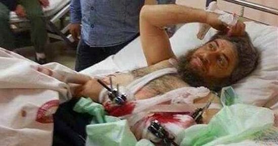 Тяжело раненый исламист принял христианство